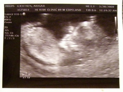 Dora at 12 wks.