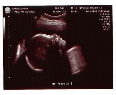 #3 at 28 wks.